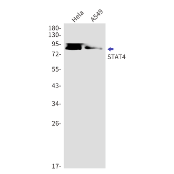 STAT4 Rabbit mAb