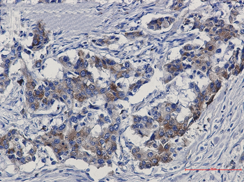 Sortilin Rabbit mAb Antibody