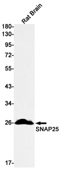 SNAP25 Rabbit mAb Antibody
