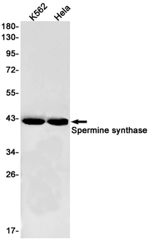 Spermine Synthase Rabbit mAb Antibody