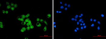 SKP1 Rabbit mAb Antibody