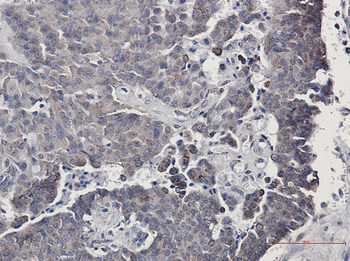 SIRT3 Rabbit mAb Antibody
