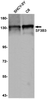 SF3B3 Rabbit mAb