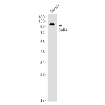 Sall4 Rabbit mAb Antibody