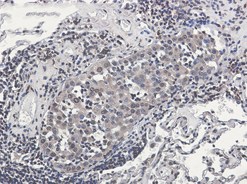 RSK2 Rabbit Monoclonal Antibody