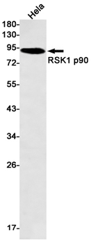 RSK1 p90 Rabbit mAb