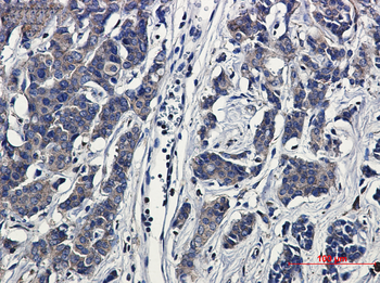 Paxillin Rabbit mAb Antibody
