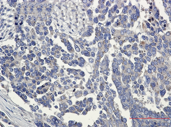 FAK Rabbit mAb Antibody