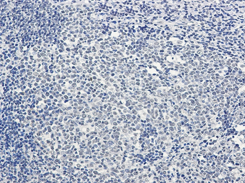 PTBP1 Rabbit Monoclonal Antibody