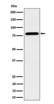 PRMT7 Rabbit mAb Antibody