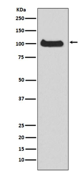 PKD1 Rabbit mAb