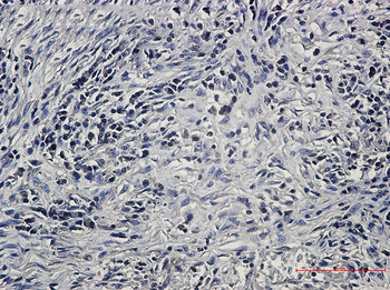PP2A alpha/beta Rabbit mAb