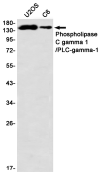 Phospholipase C gamma 1 Rabbit mAb Antibody