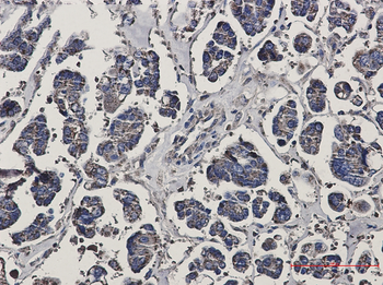 Prohibitin Rabbit mAb Antibody