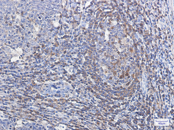 Profilin 1 Rabbit Monoclonal Antibody
