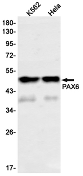 PAX6 Rabbit mAb Antibody