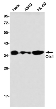 OTX1 Rabbit mAb Antibody