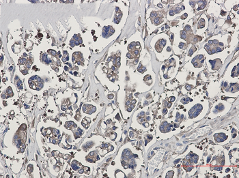 Optineurin Rabbit Monoclonal Antibody