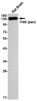 Trk B Rabbit mAb Antibody