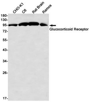 Glucocorticoid Receptor Rabbit mAb Antibody