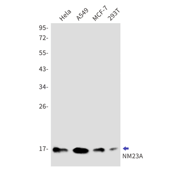 NM23A Rabbit mAb Antibody