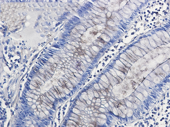 Entactin Rabbit mAb Antibody