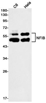 NFIB Rabbit mAb Antibody