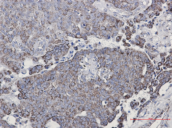 NDUFC2 Rabbit mAb Antibody