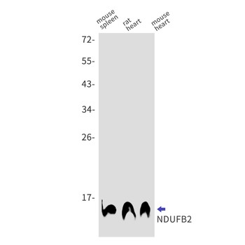 NDUFB2 Rabbit Monoclonal Antibody