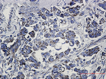 Methylmalonyl Coenzyme A mutase Rabbit mAb Antibody