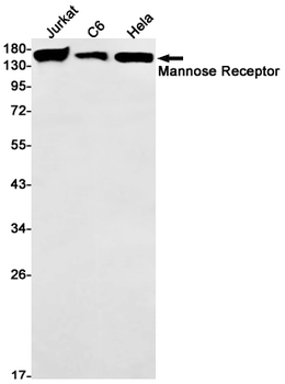Mannose Receptor Rabbit mAb Antibody