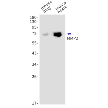 MMP2 Rabbit mAb Antibody