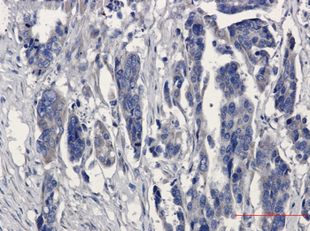 MGST1 Rabbit mAb Antibody
