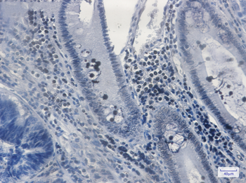 MGMT Rabbit mAb Antibody