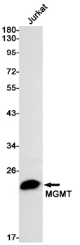 MGMT Rabbit mAb Antibody