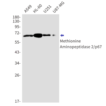 Methionine Aminopeptidase 2 Rabbit mAb Antibody