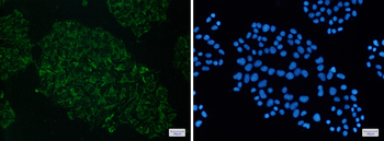 ME2 Rabbit mAb Antibody