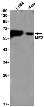 ME2 Rabbit mAb Antibody