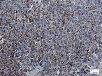 MDH2 Rabbit Monoclonal Antibody