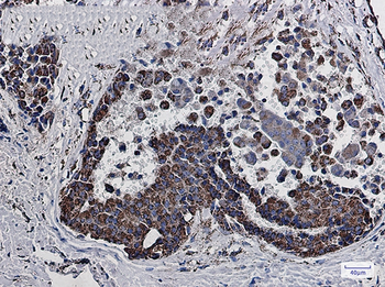 MDH2 Rabbit Monoclonal Antibody
