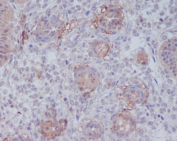 CD146 Rabbit mAb