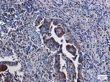 LAMP2 Rabbit mAb Antibody