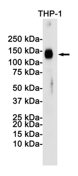 LAMP2 Rabbit mAb Antibody