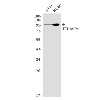 ITCH Rabbit mAb Antibody