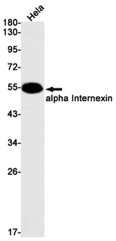 alpha Internexin Rabbit mAb Antibody