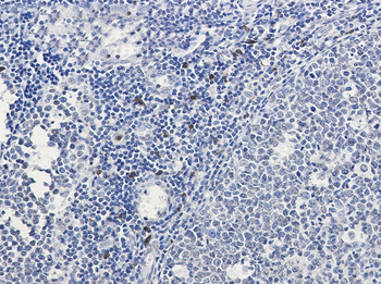 IL 26 Rabbit Monoclonal Antibody