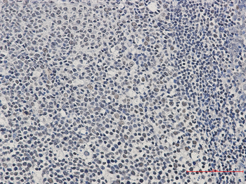 IKZF3 Rabbit mAb Antibody