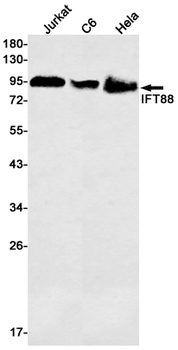 IFT88 Rabbit mAb Antibody