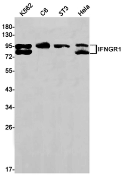 Interferon gamma Receptor 1 Rabbit mAb