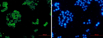 Insulin Degrading Enzyme Rabbit mAb Antibody